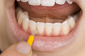 Zahnreinigung mit kleiner Bürste
